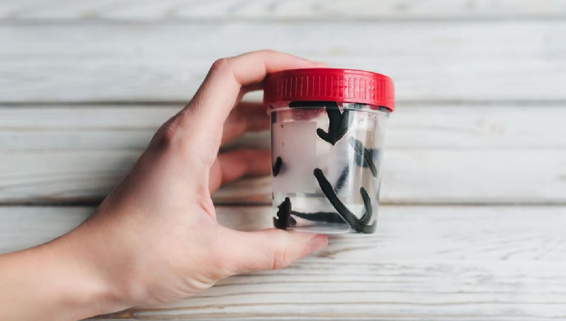 hirudoterapia warszawa